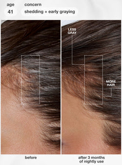 K18 FutureIQ™ Biomimetic Hair Longevity Serum